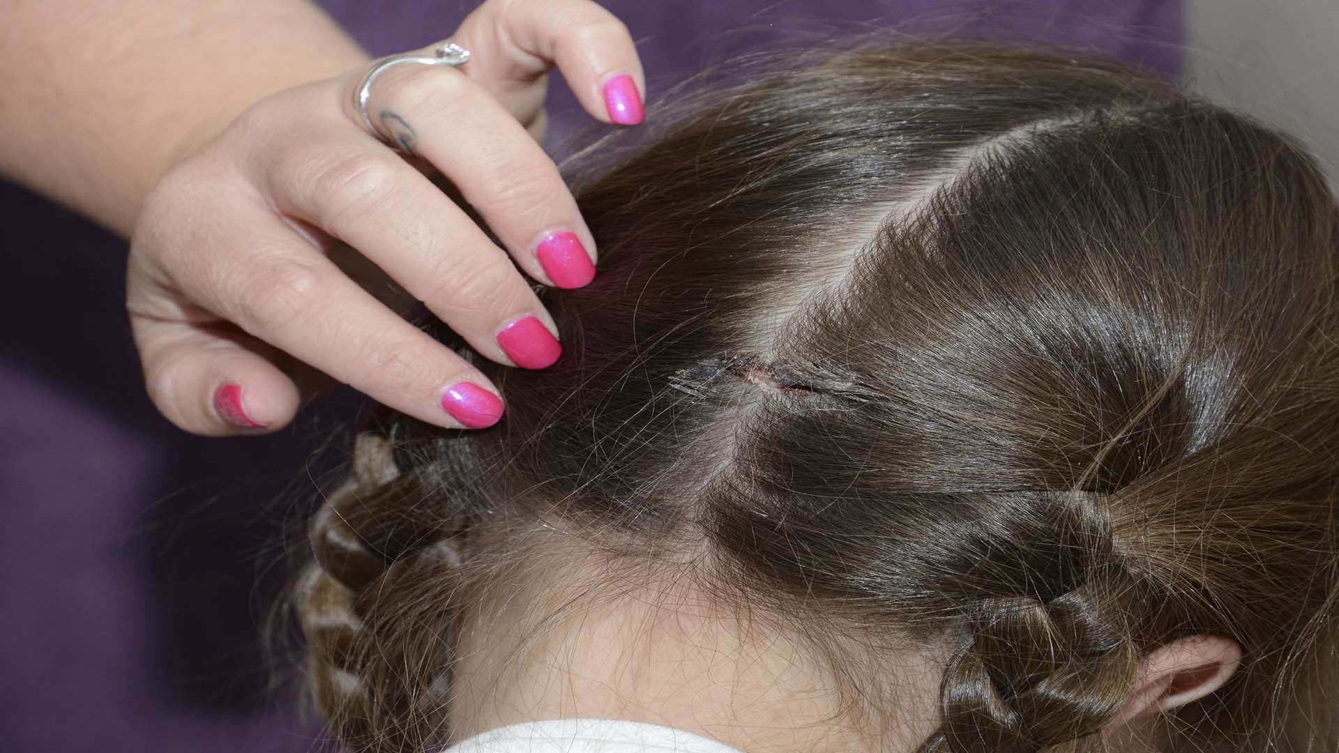 The gash in Lily's head