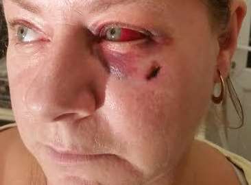 Debbie Green's injuries following the violent assault
