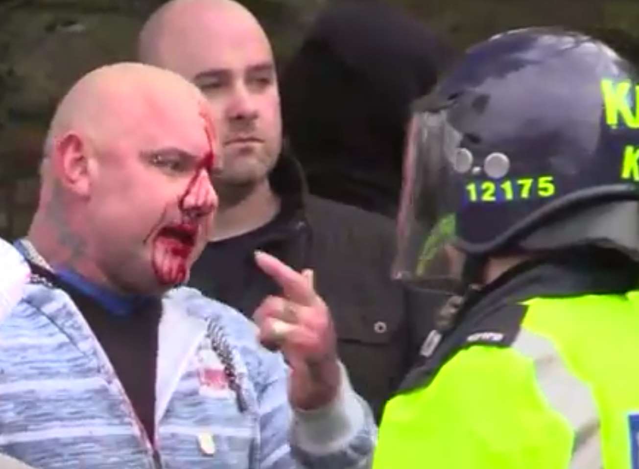 Blood pours down the face of injured man