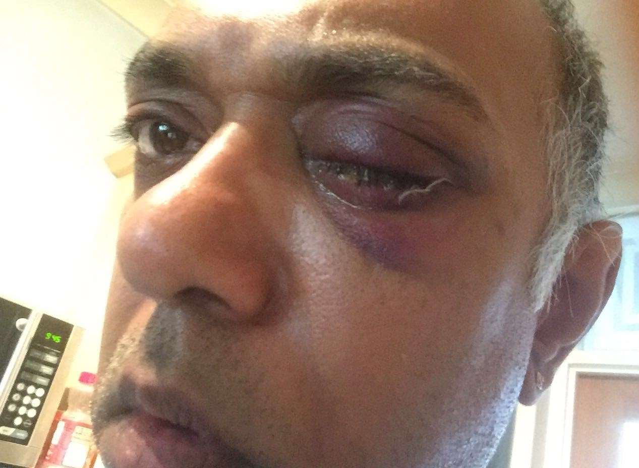 Paul Ramsamy might never return to work after the attack