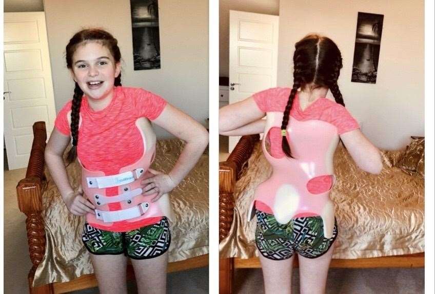 Izzy has to wear a brace to treat the scoliosis (23538830)