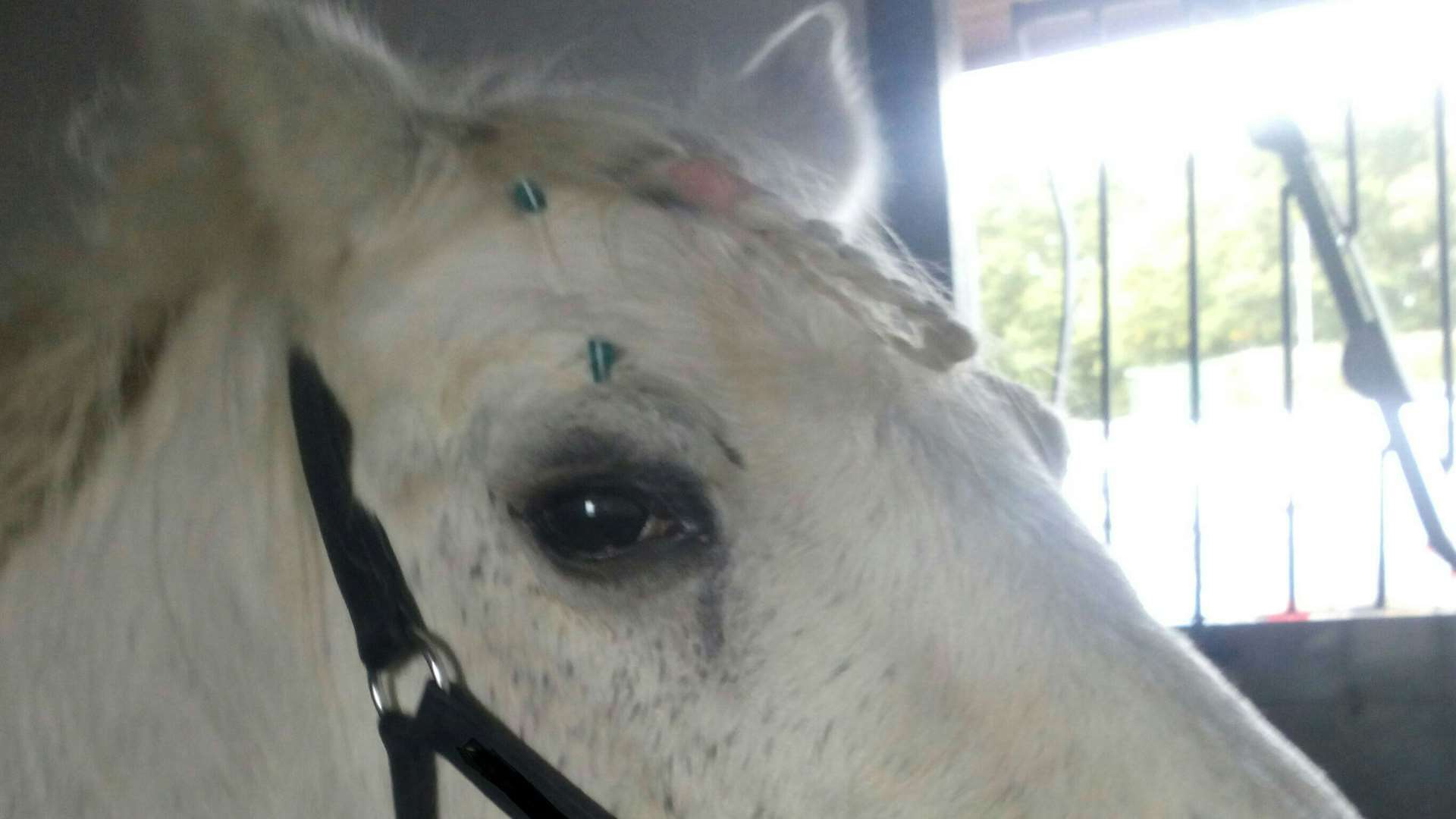 Silver's right eye could requires drastic surgery.