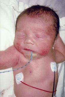 Baby Lennon born at DVH on April 15
