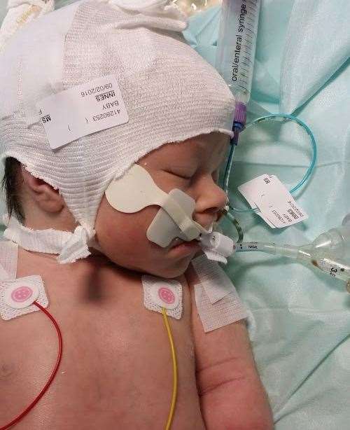 Sophie was starved of oxygen during labour and had sepsis as well as MAS. Picture: Emma Innes