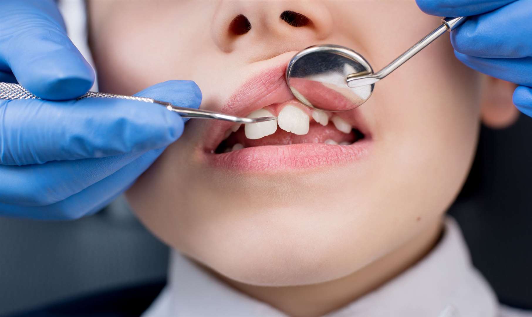 Many dentists are moving from the NHS to private practice and are no longer accepting NHS patients credit: istock/anatoliy gleb
