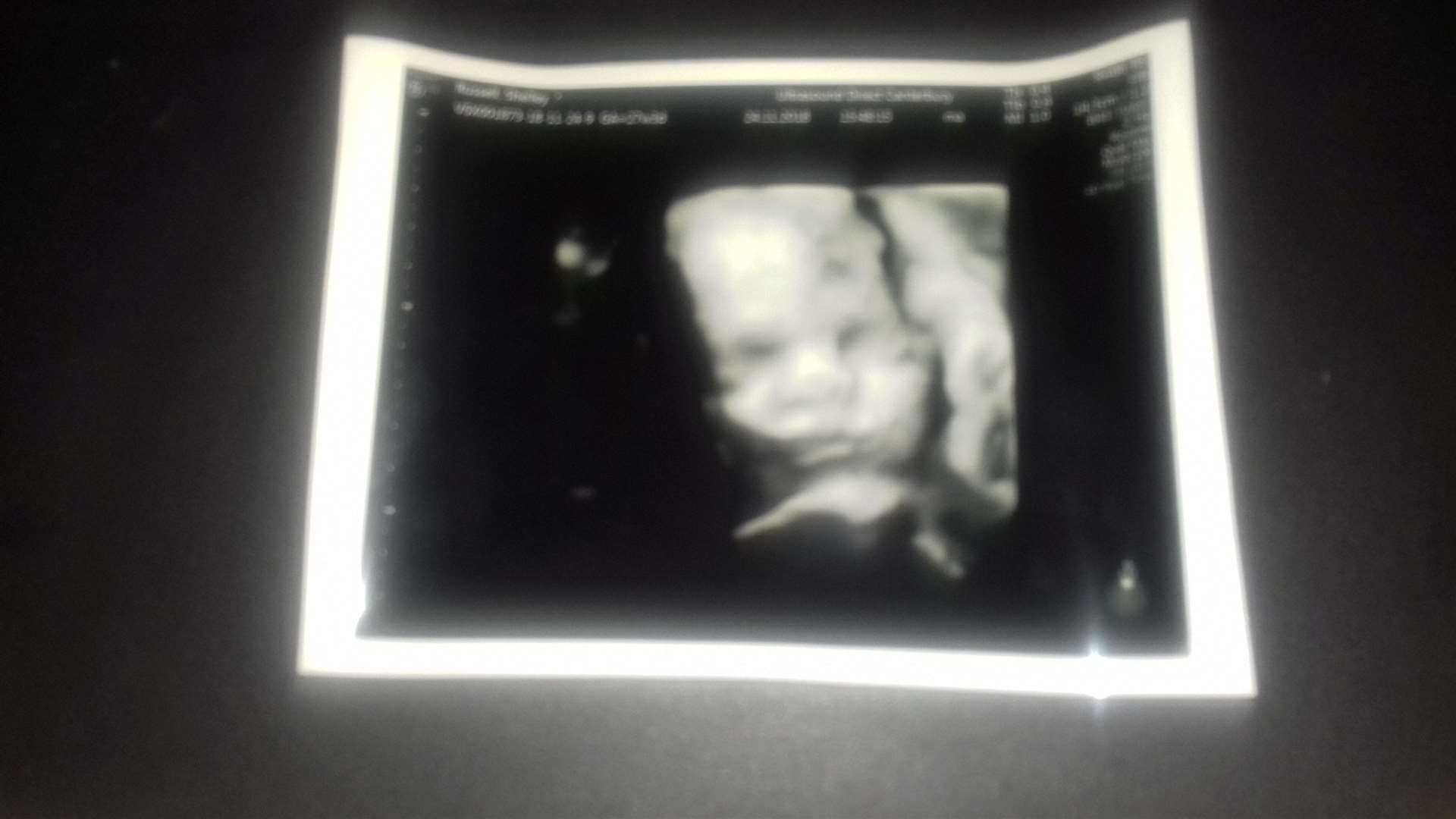 The baby scan of Tallulah-Rai Picture: SWNS