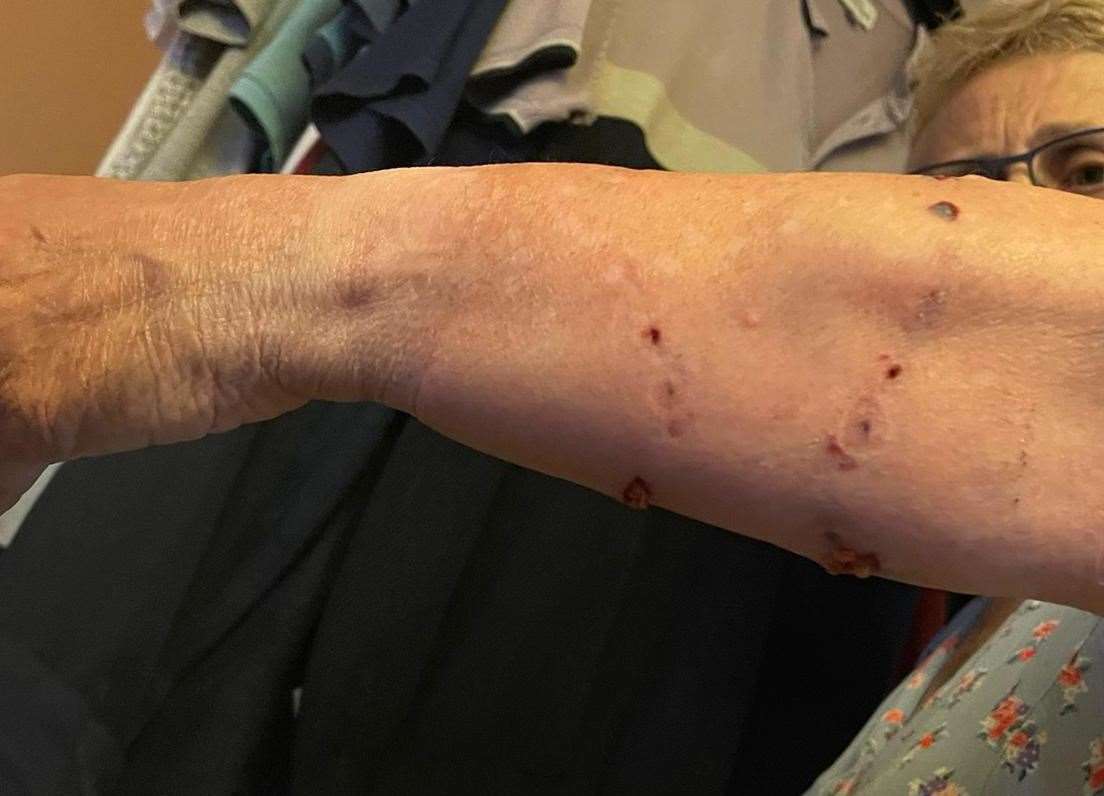 Fay Hagger was attacked by a dog in Kennington, Ashford. Picture: Fay Hagger