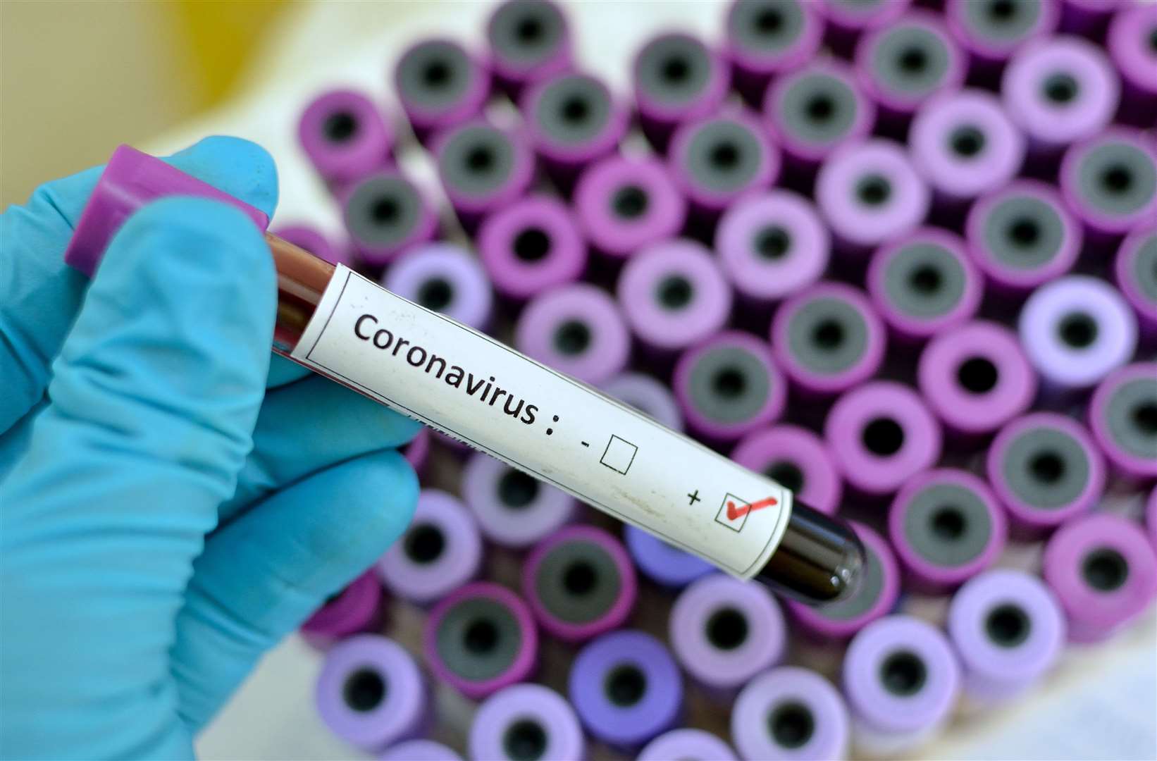 A committee of MPs has criticised the government's Covid-19 testing programme as slow and inadequate