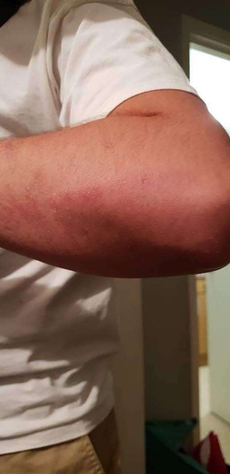 A teenage boy from Gravesend was left with bruises after being assaulted with a baton. (2444690)