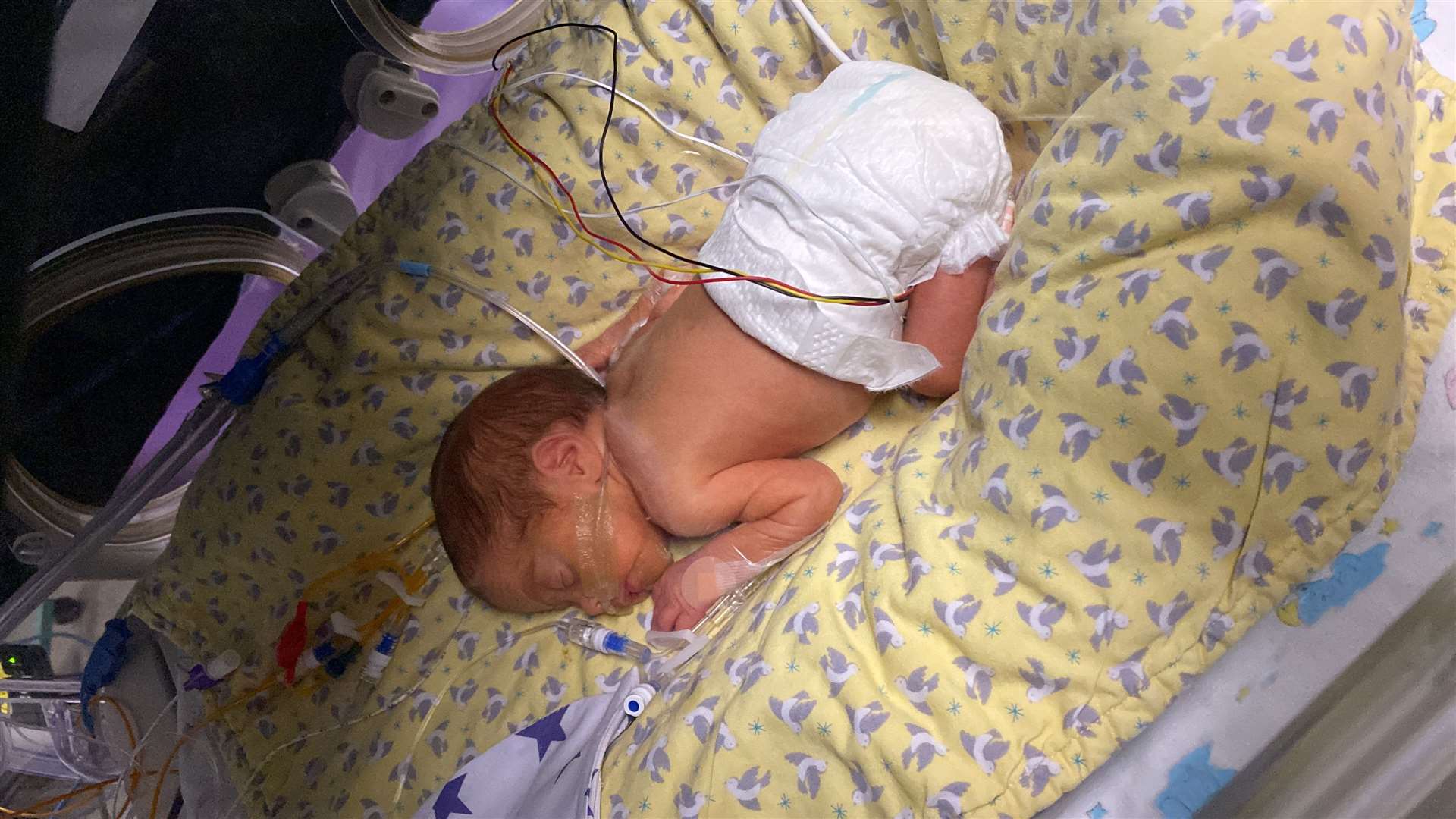 Little Annayah in the neonatal unit
