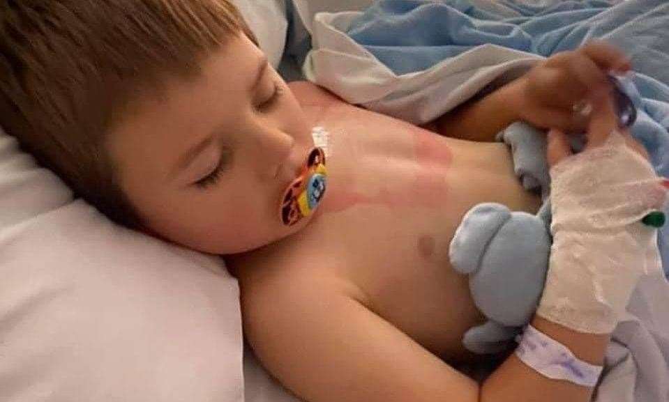 The young boy in hospital just after having his first surgery. Picture: Laura Cockburn