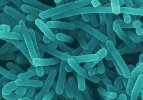 Listeria poses more of a risk to vulnerable groups. Image: Stock photo.