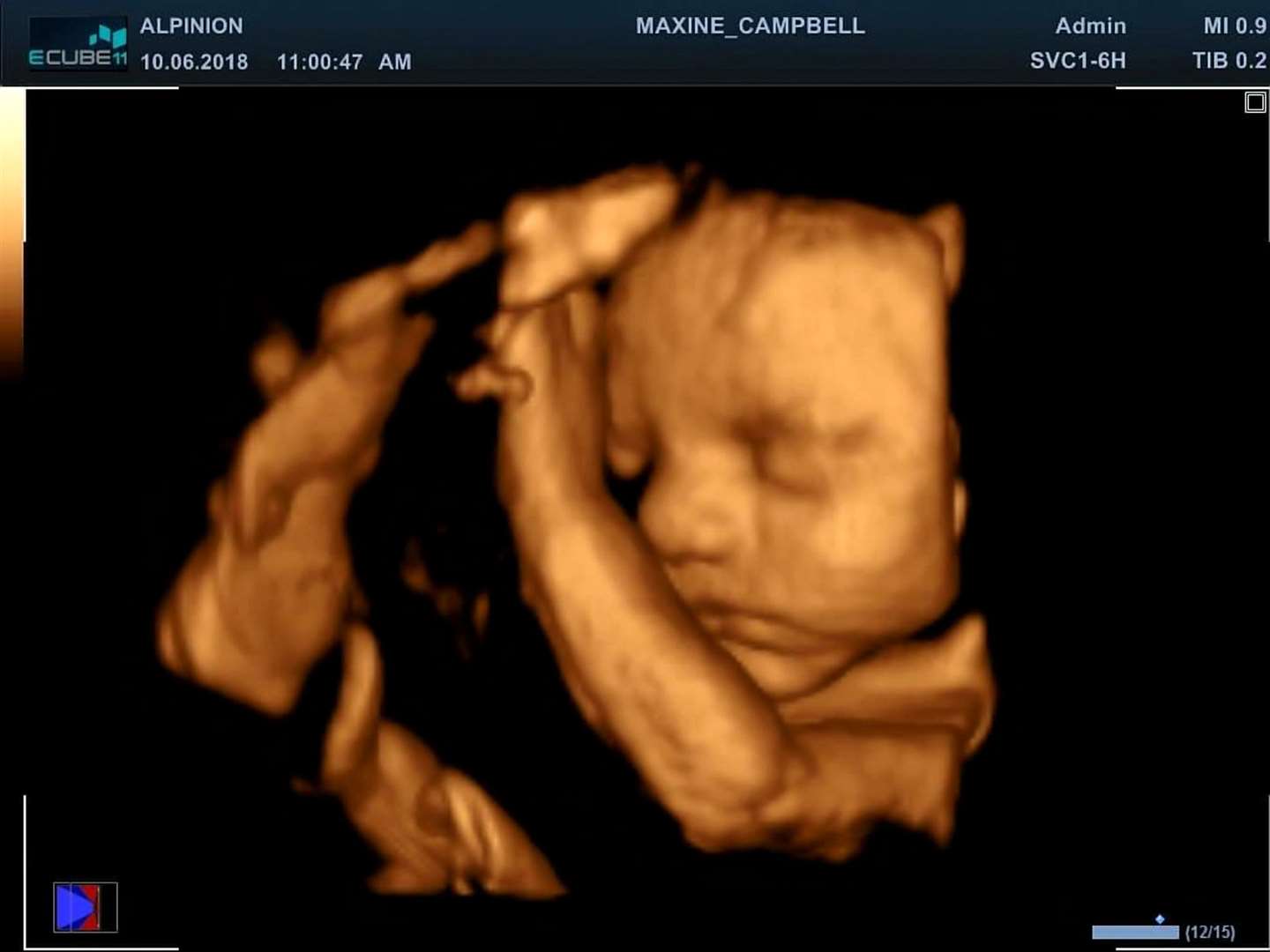 The scan of baby Mateo. Picture: SWNS