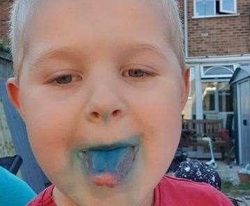 Archie Brazier's tongue and mouth were turned blue