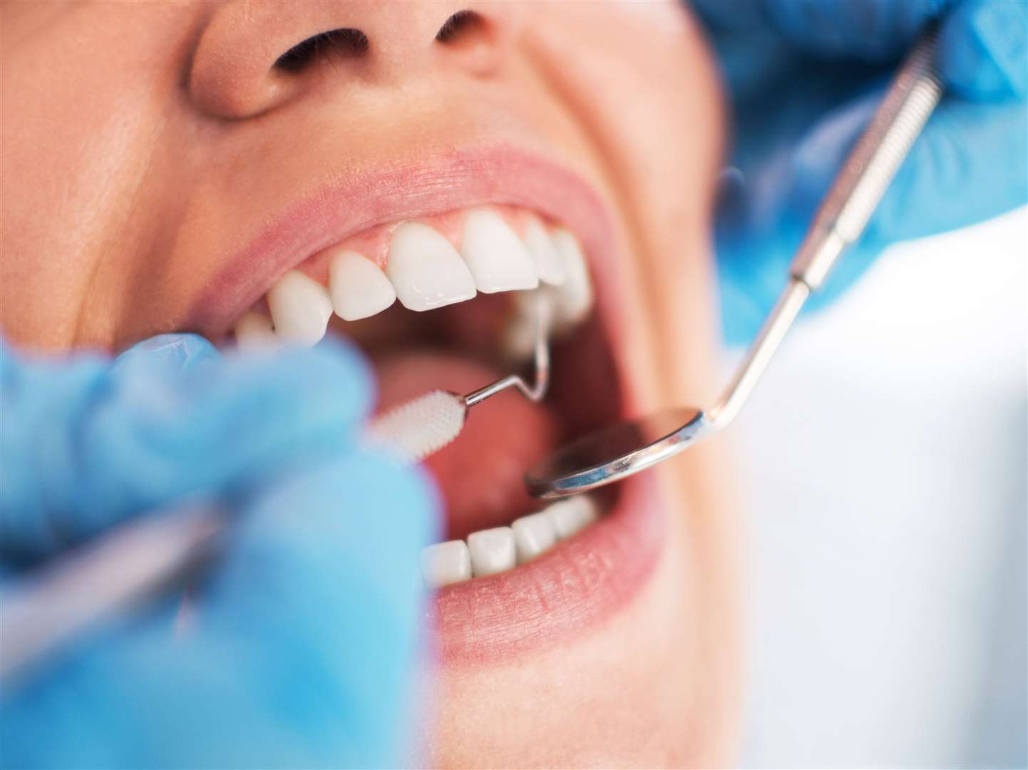 A shortage of NHS dentists has left people unable to access affordable dental care. Picture: iStock