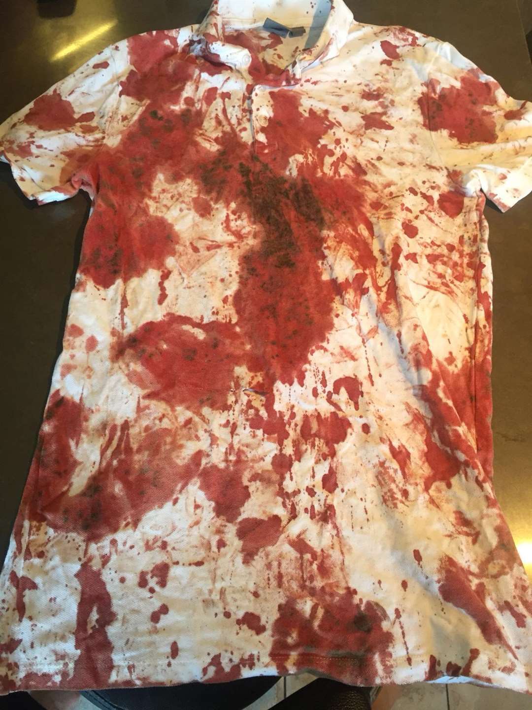 The teenagers blood-stained shirt