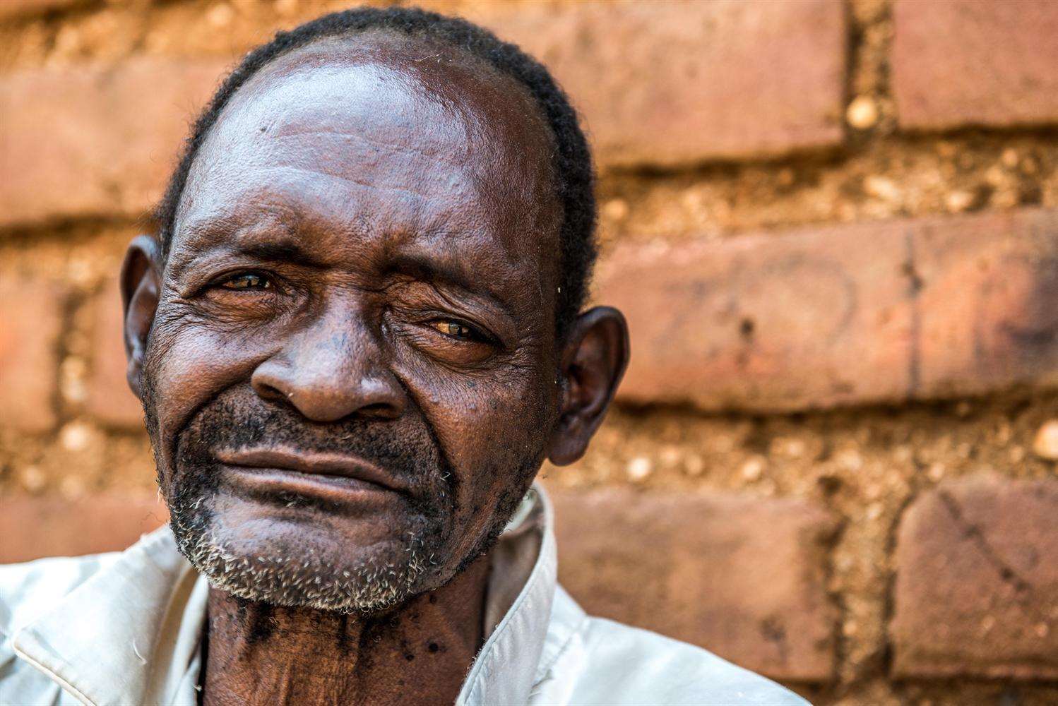 Malawi man Winesi March is having his sight restored. Picture: Rachel Palmer Photography