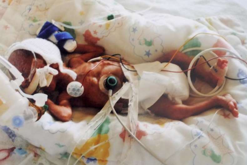 Little Owen in a premature baby unit aged just one day