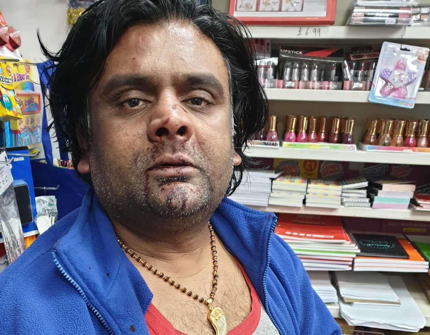 Umesh Patel, from M&P News in Shepway, Maidstone, was left bloodied and bruised after the attack. Picture: Umesh Patel