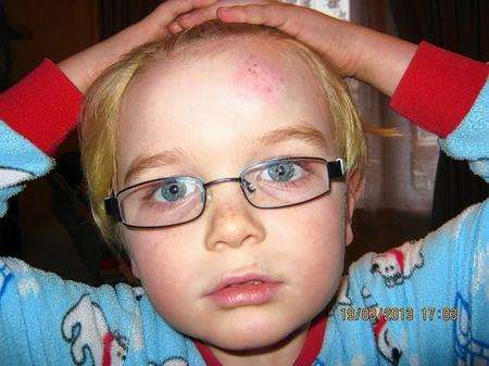 Gem Reed's son Oren, five, hit his head after he was jumped on by a brown whippet