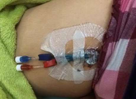 Xena undergoing dialysis