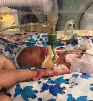 Rafferty in the neonatal unit. He weighed just 900 grams when born