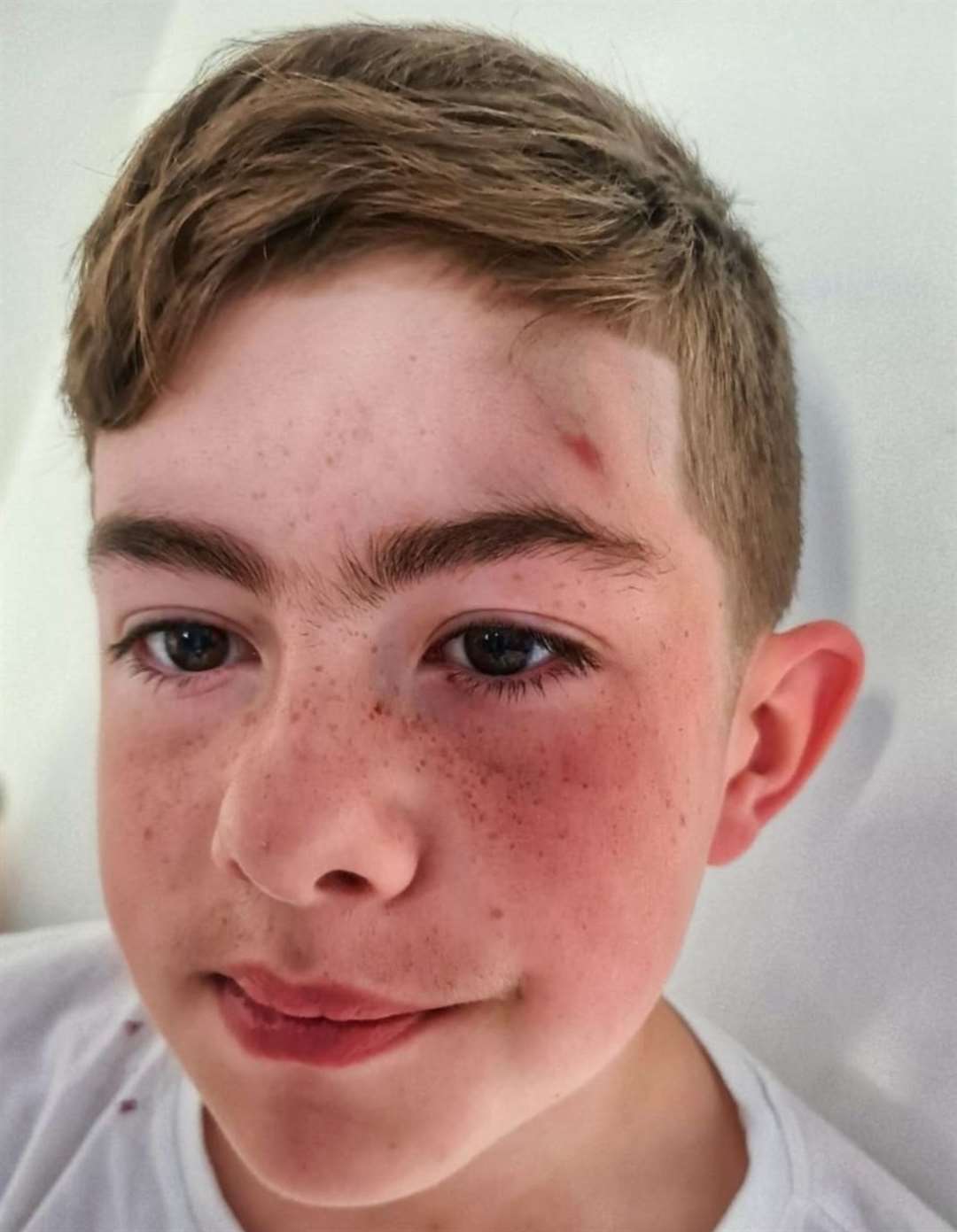Owen suffered cuts and bruises to his face