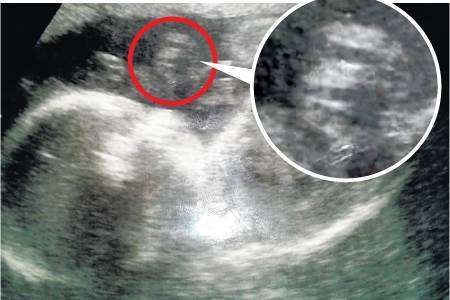 Mark and Dawn Smith think they have spotted Margaret Thatcher in a baby scan