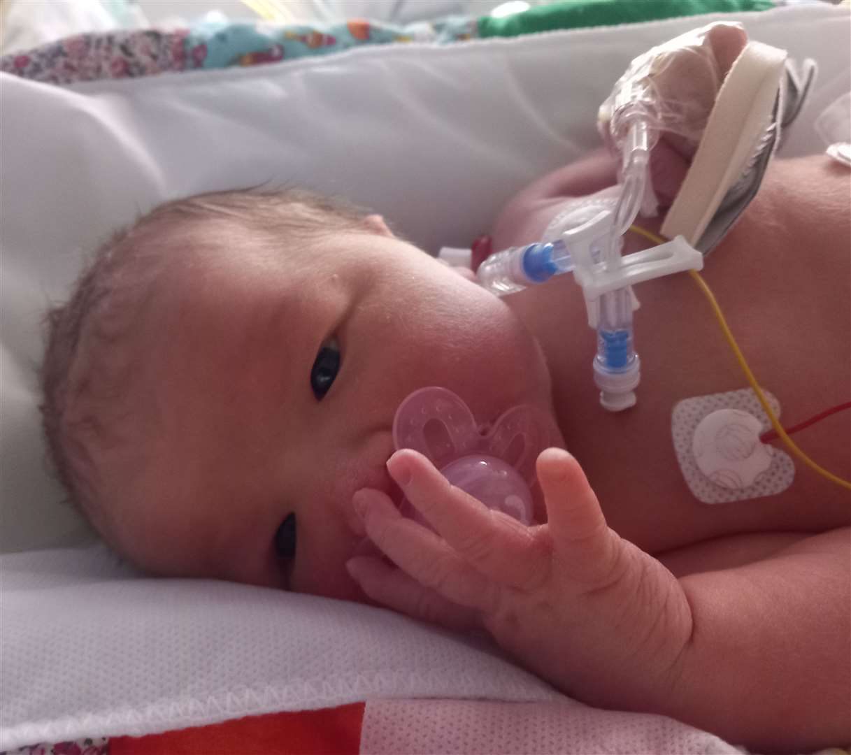 Newborn Maisie in a hospital incubator