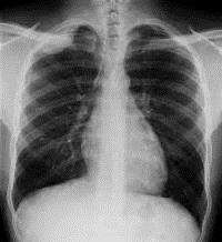 An x-ray. Stock picture