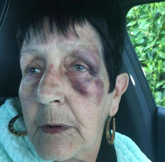 Irene Smallman was left with heavy bruising after being assaulted in her own back garden, in Petham Green, Twydall