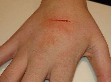 Karen Evans daughter's hand was slashed in Barming, Maidstone