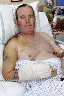 Julian Allerhead, from Gravesend, injured in a hit and run incident in Maidstone