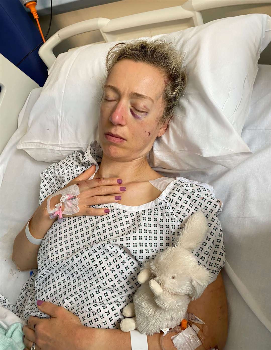 Kirsten Putland in hospital after the accident in 2022