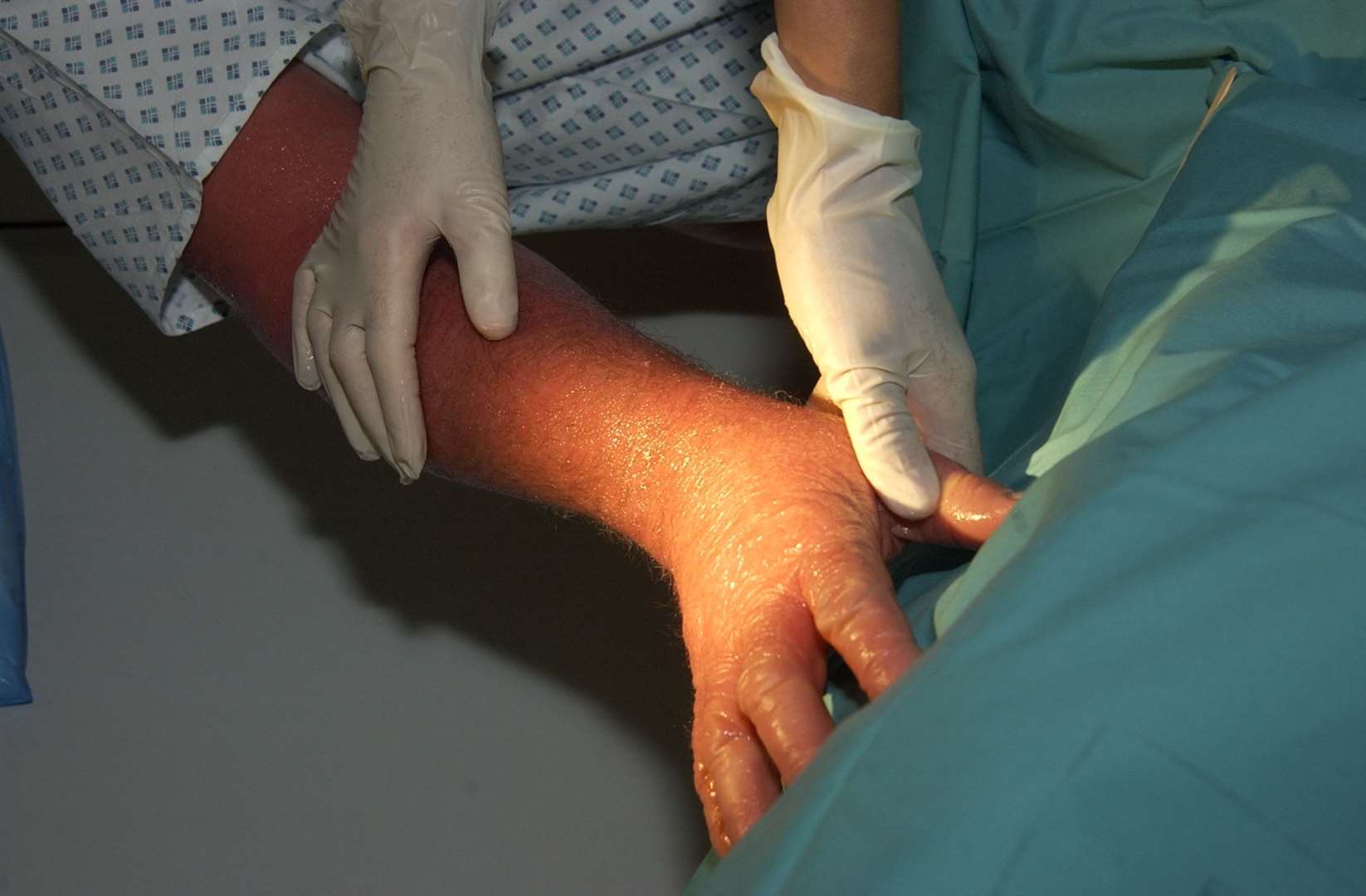 Medway Maritime Hospital ceased its dermatology service at the start of the month