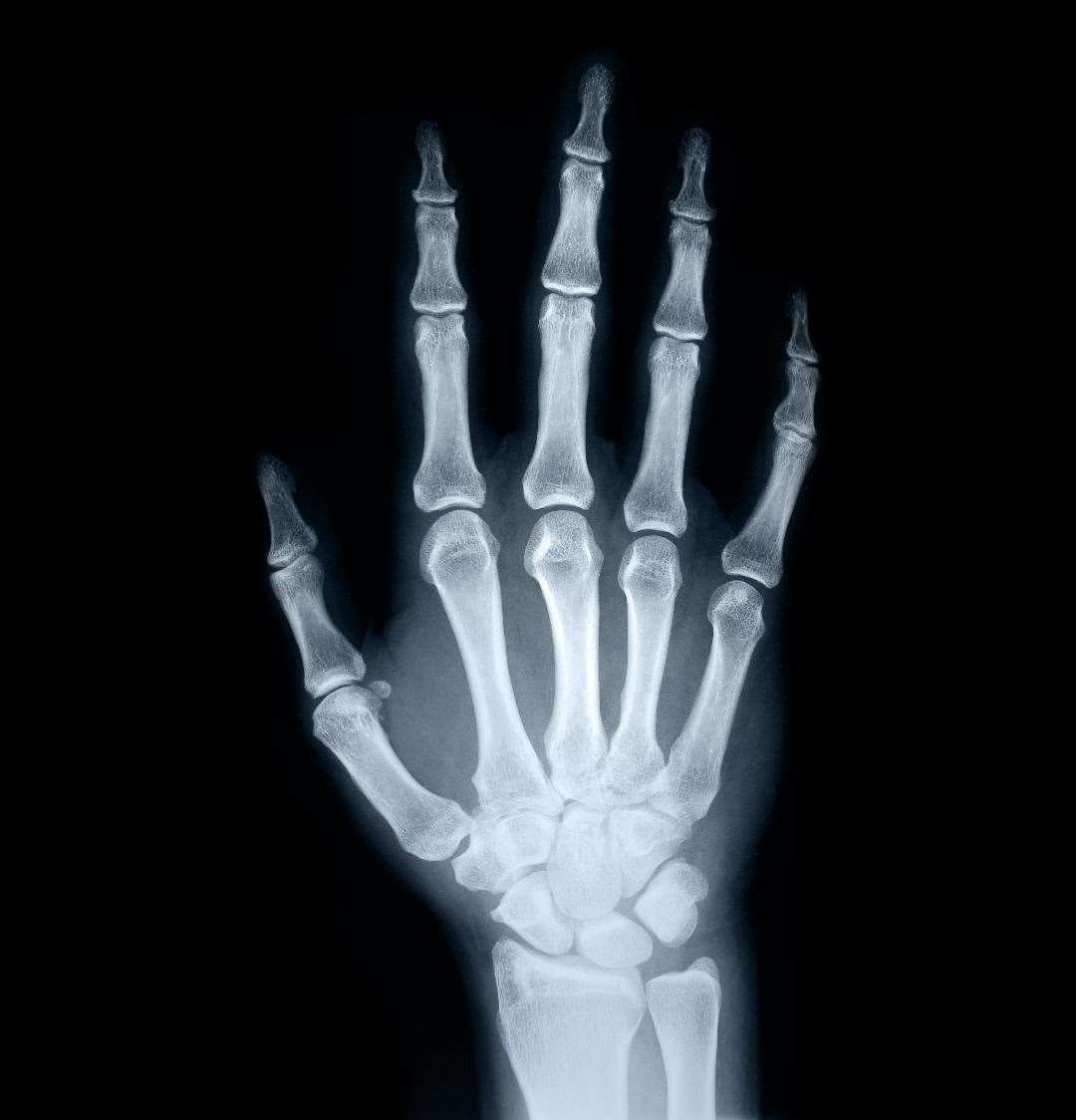 Marie Curie developed the technique of making X-rays