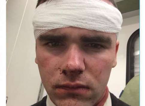 Ryan Sadler, 19, was attacked at McDonalds in Strood