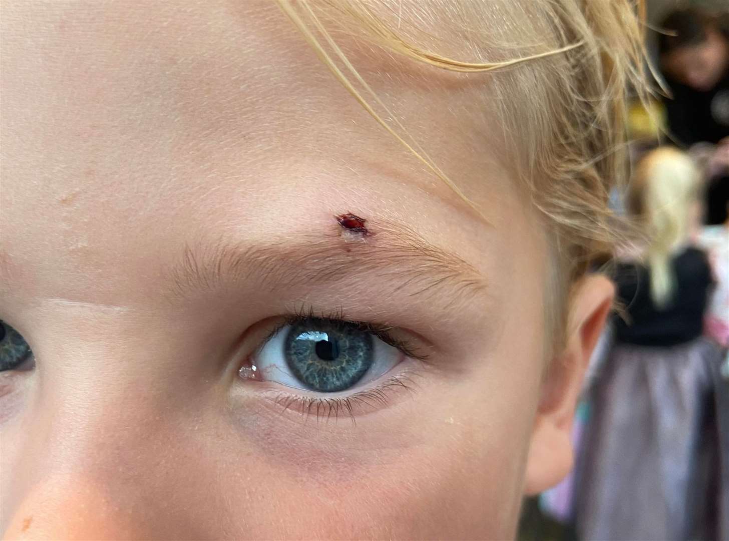 The mother says it could have been a lot worse if Georgie was taller as it could have gone into his eye. Picture: Sophie Howes