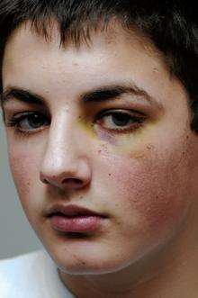 Michael Dale, 13, who was attacked for £30 and cigarettes