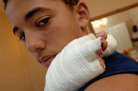 Kobie Ambrose, 14, whose hand was severely injured in a dog attack