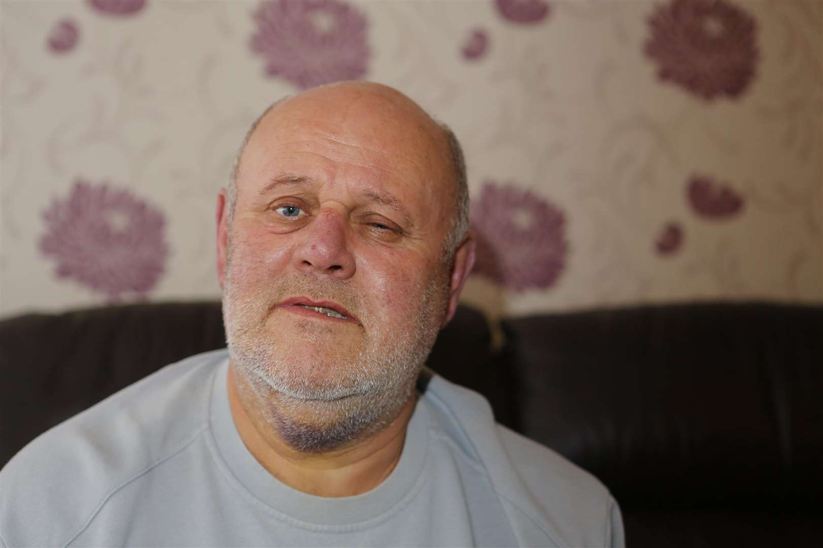 Robert Barlow has a broken jaw after he was hit with a metal pole by youths outside his home