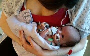 The 33-year-old says she didn't get to hold her daughter until she was nine days old. Picture: Emma Innes