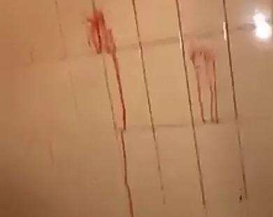Blood spatters on the wall. Pic: Ashleigh Clark (6162840)