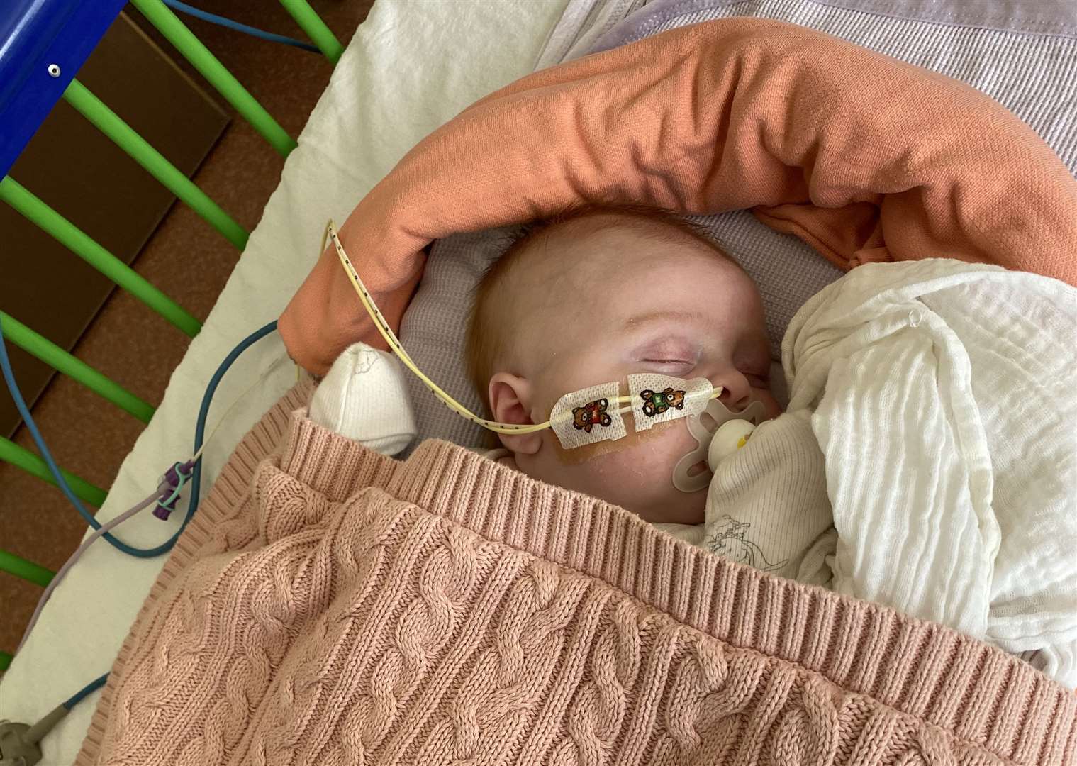 Mia was put on a ventilator for seven days before surgery