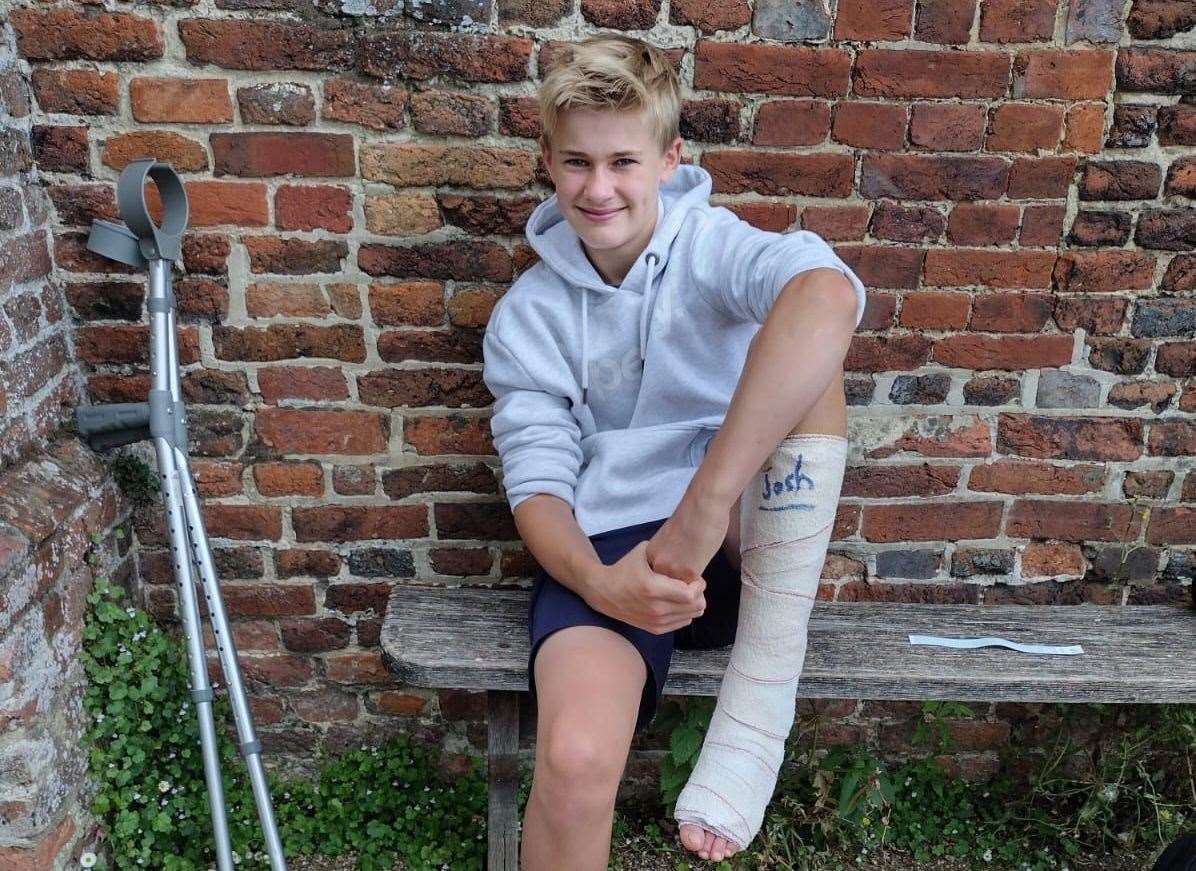 Alex will be in a cast for the next six weeks after his operation