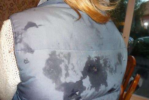 Anna Robinson’s torn jacket after being attacked by the doberman