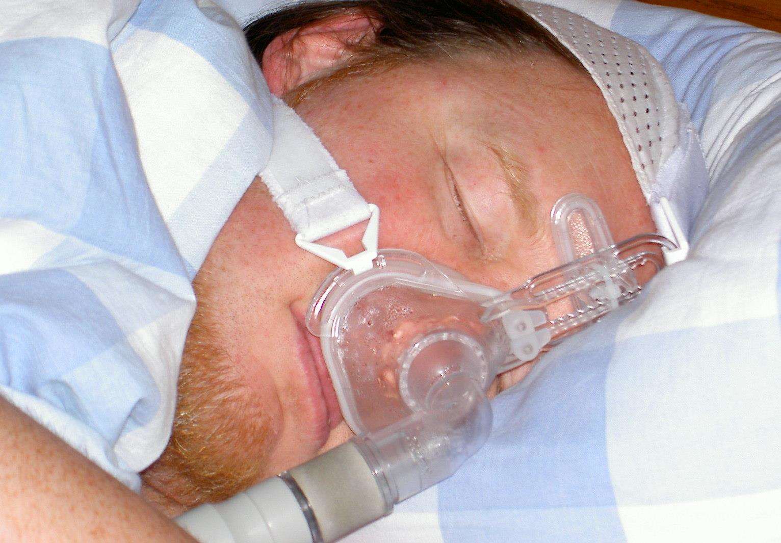 A CPAP (continuous positive airway pressure) therapy mask is considered the best treatment for sleep apnea