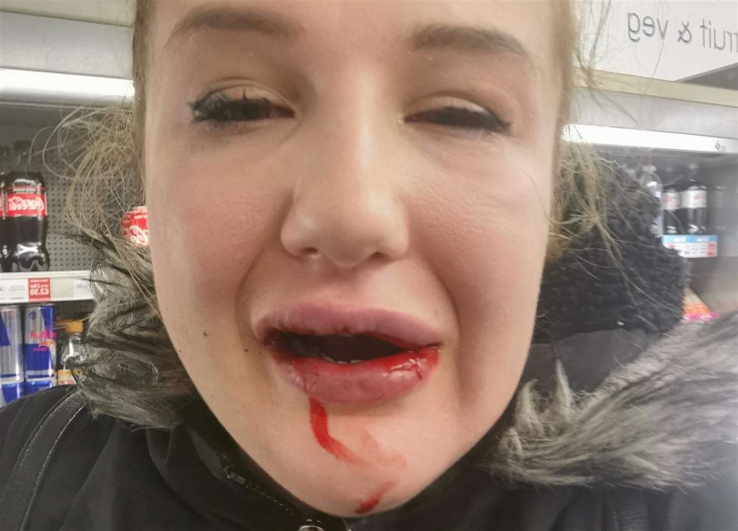 Holly was riding home from work when the attack happened