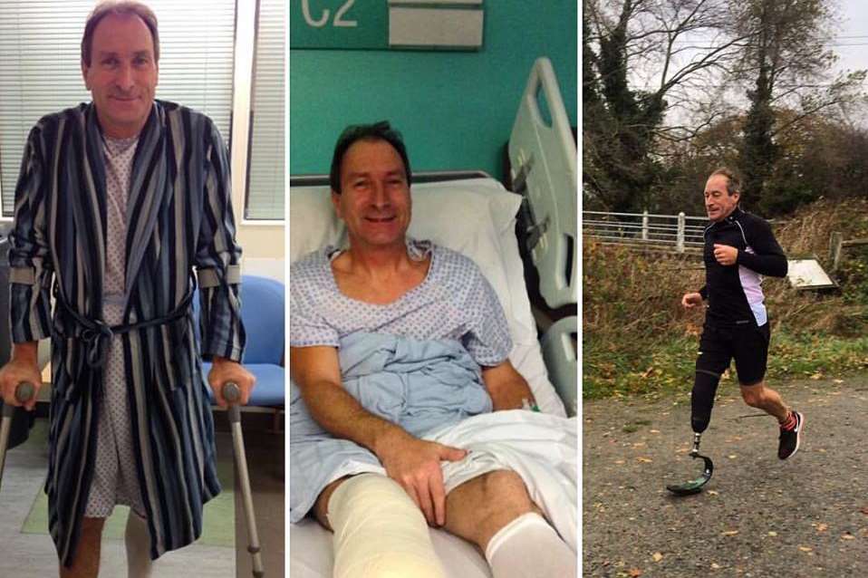 Chris Luckhurst in hospital before his amputation, and training with a prosthetic running blade.