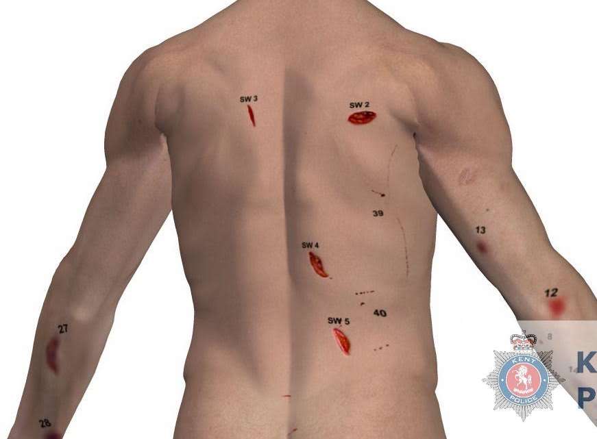 The injuries to Mr Gorecki. Picture: Kent Police